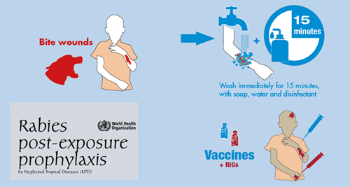 Rabies post-exposure prophylaxis illustration
